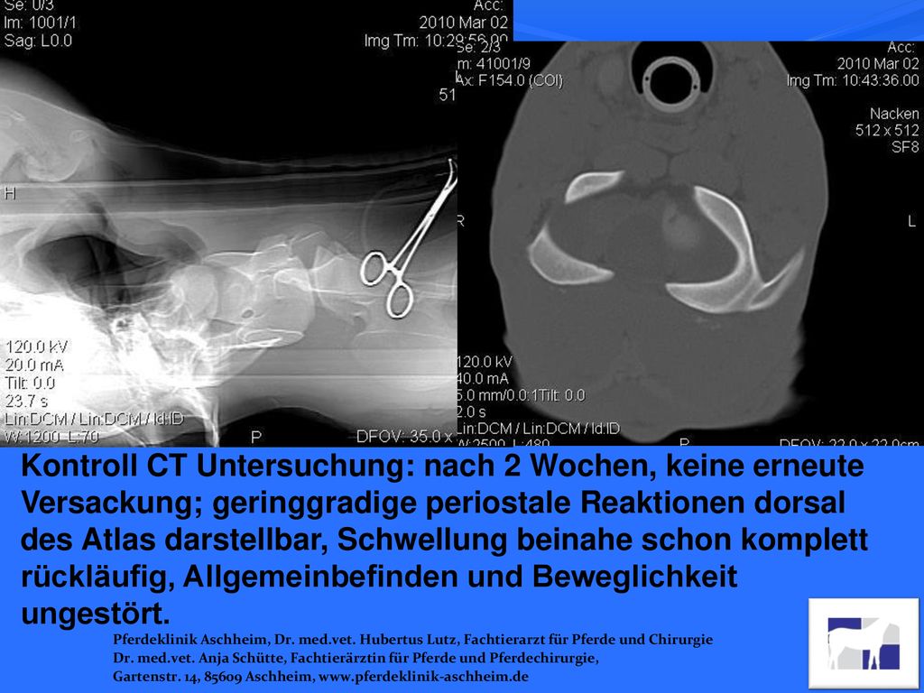 Kontroll CT Untersuchung: nach 2 Wochen, keine erneute Versackung; geringgradige periostale Reaktionen dorsal des Atlas darstellbar, Schwellung beinahe schon komplett rückläufig, Allgemeinbefinden und Beweglichkeit ungestört.