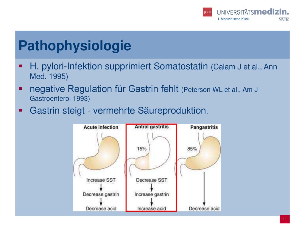 Pathophysiologie H. pylori-Infektion supprimiert Somatostatin (Calam J et al., Ann Med. 1995)