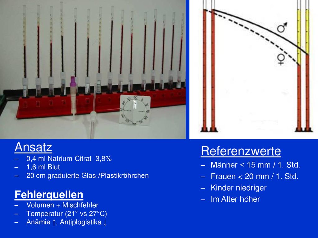 Ansatz Referenzwerte Fehlerquellen Männer < 15 mm / 1. Std.