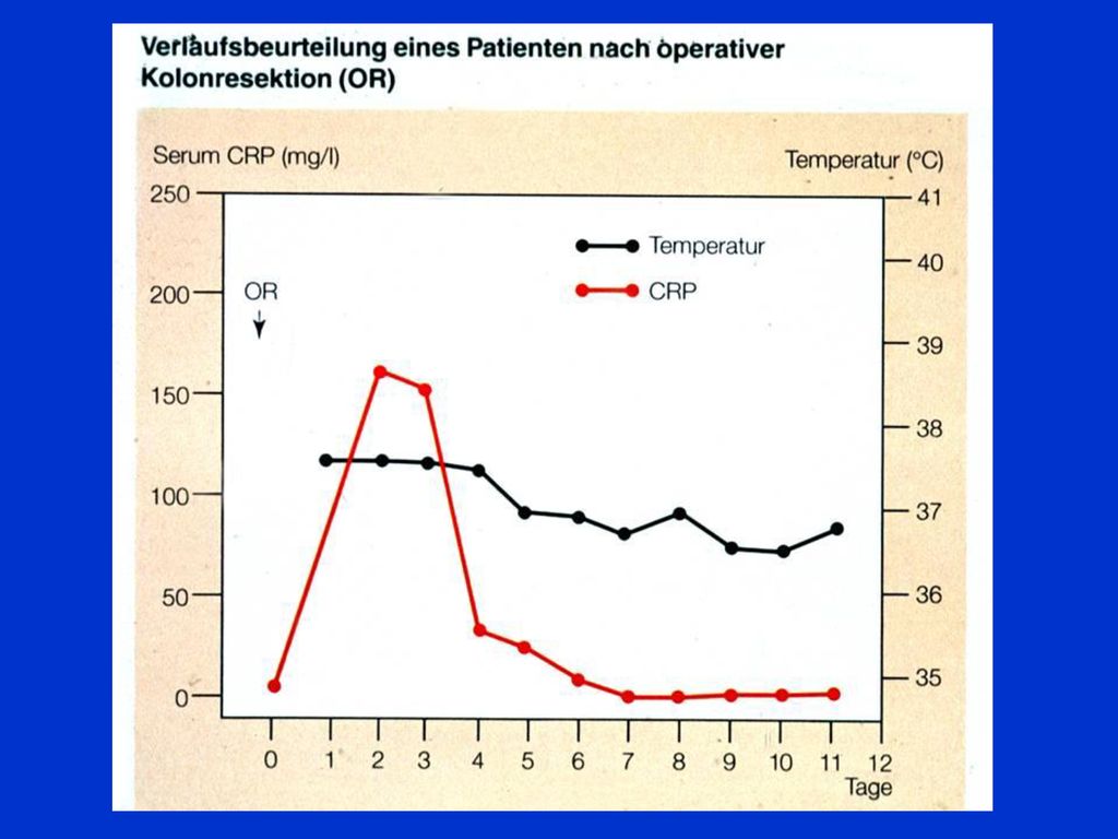 Statisch: Screening: neonateologie, Früherkennung: Synovitis. Ausschlußdiagnostik: Infektion. Differentialdiagnose: bakteriell vs viral.
