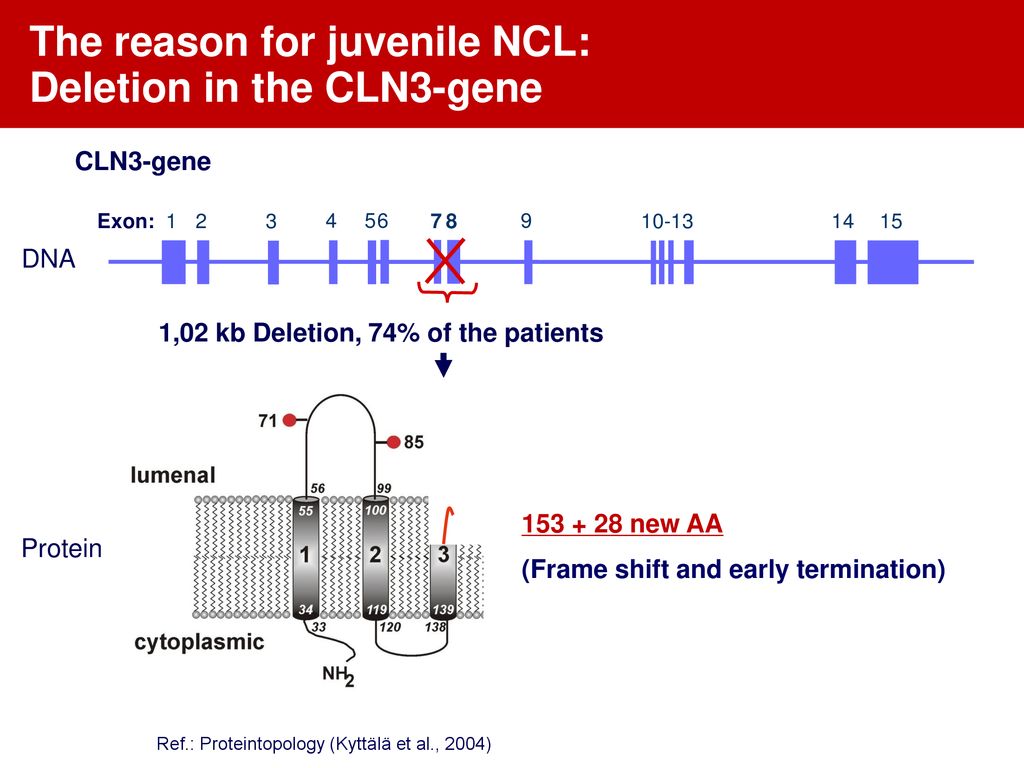 The reason for juvenile NCL: Deletion in the CLN3-gene