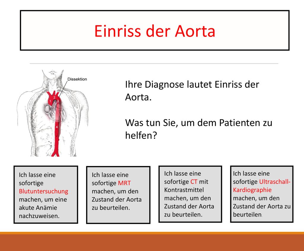 Einriss der Aorta Ihre Diagnose lautet Einriss der Aorta.