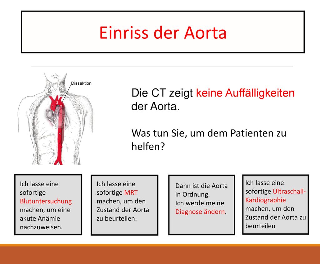 Einriss der Aorta Die CT zeigt keine Auffälligkeiten der Aorta.