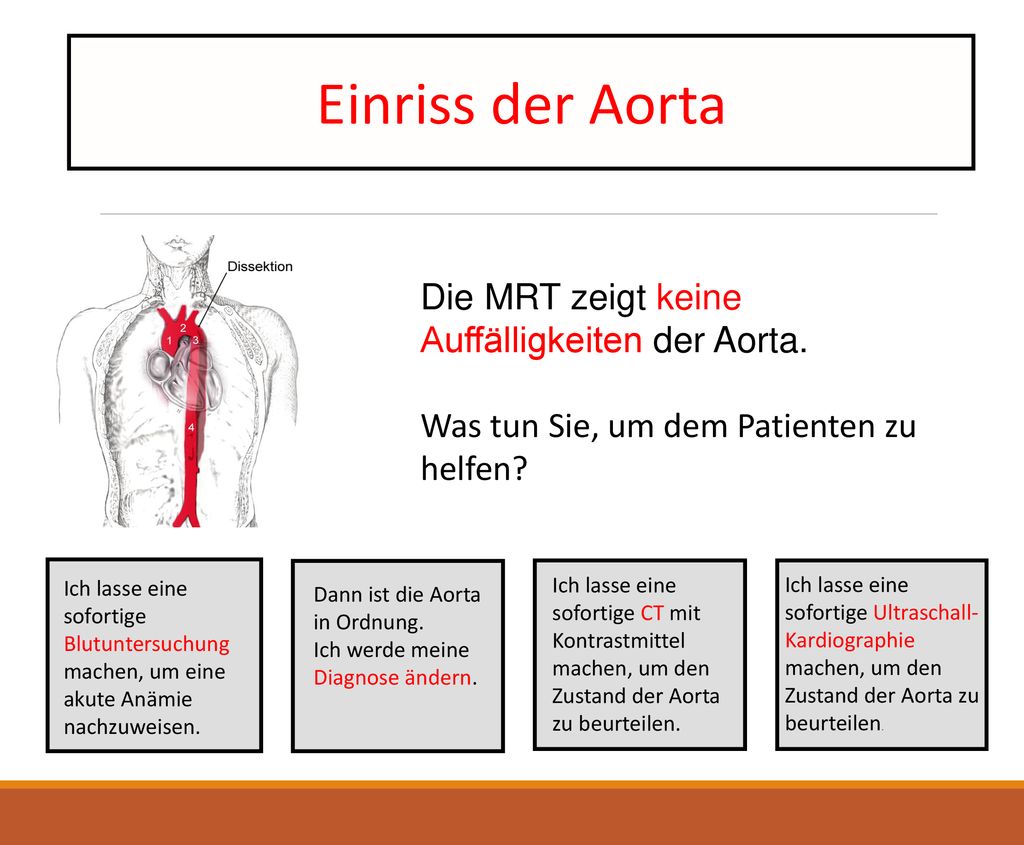 Einriss der Aorta Die MRT zeigt keine Auffälligkeiten der Aorta.