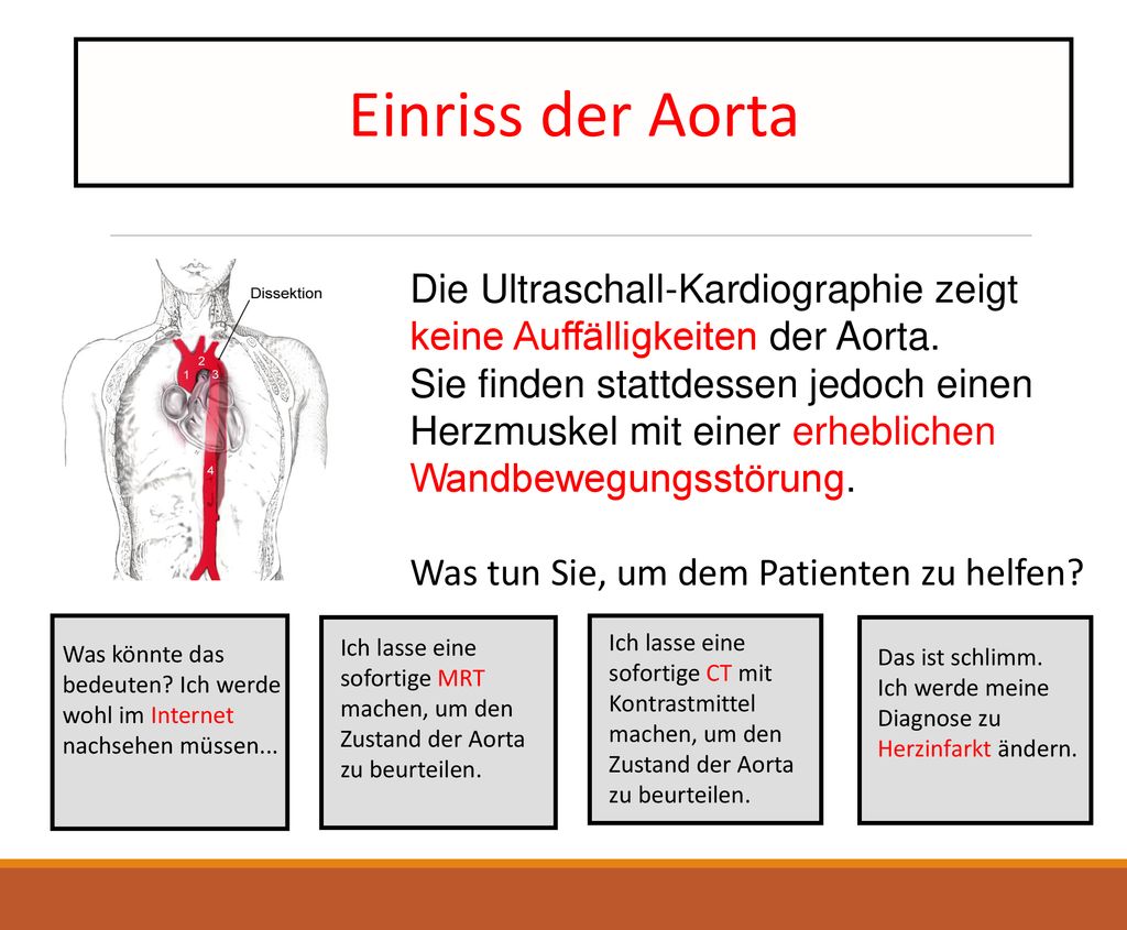 Einriss der Aorta Die Ultraschall-Kardiographie zeigt keine Auffälligkeiten der Aorta.