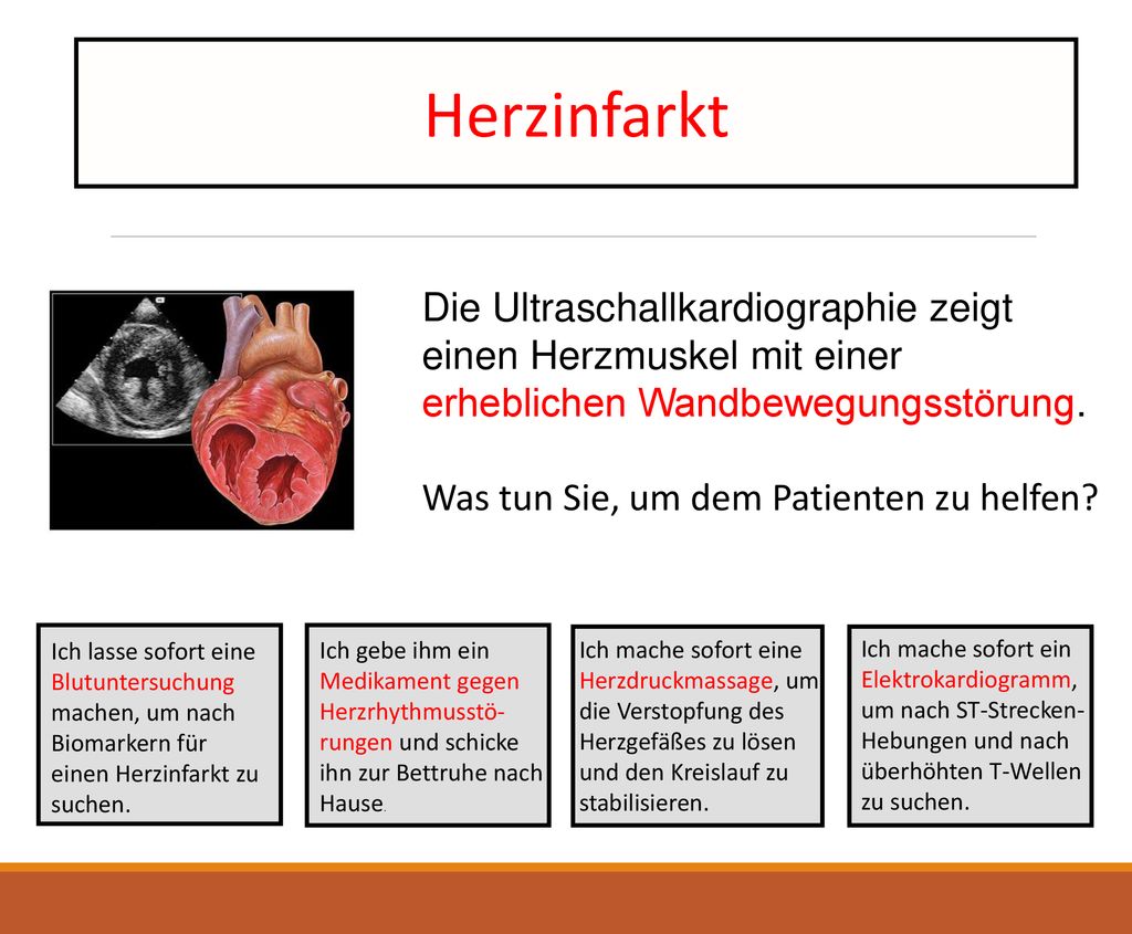 Herzinfarkt Die Ultraschallkardiographie zeigt einen Herzmuskel mit einer erheblichen Wandbewegungsstörung.