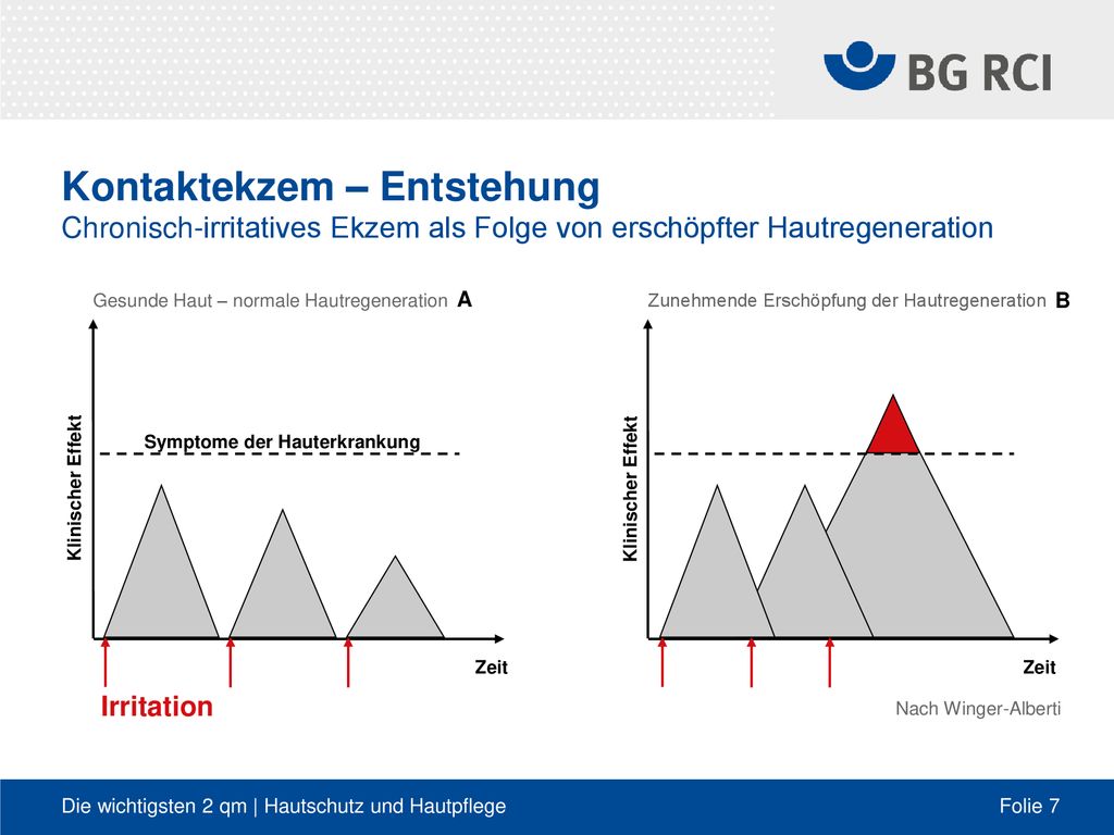 Kontaktekzem – Entstehung Chronisch-irritatives Ekzem als Folge von erschöpfter Hautregeneration
