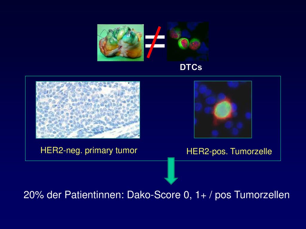 20% der Patientinnen: Dako-Score 0, 1+ / pos Tumorzellen