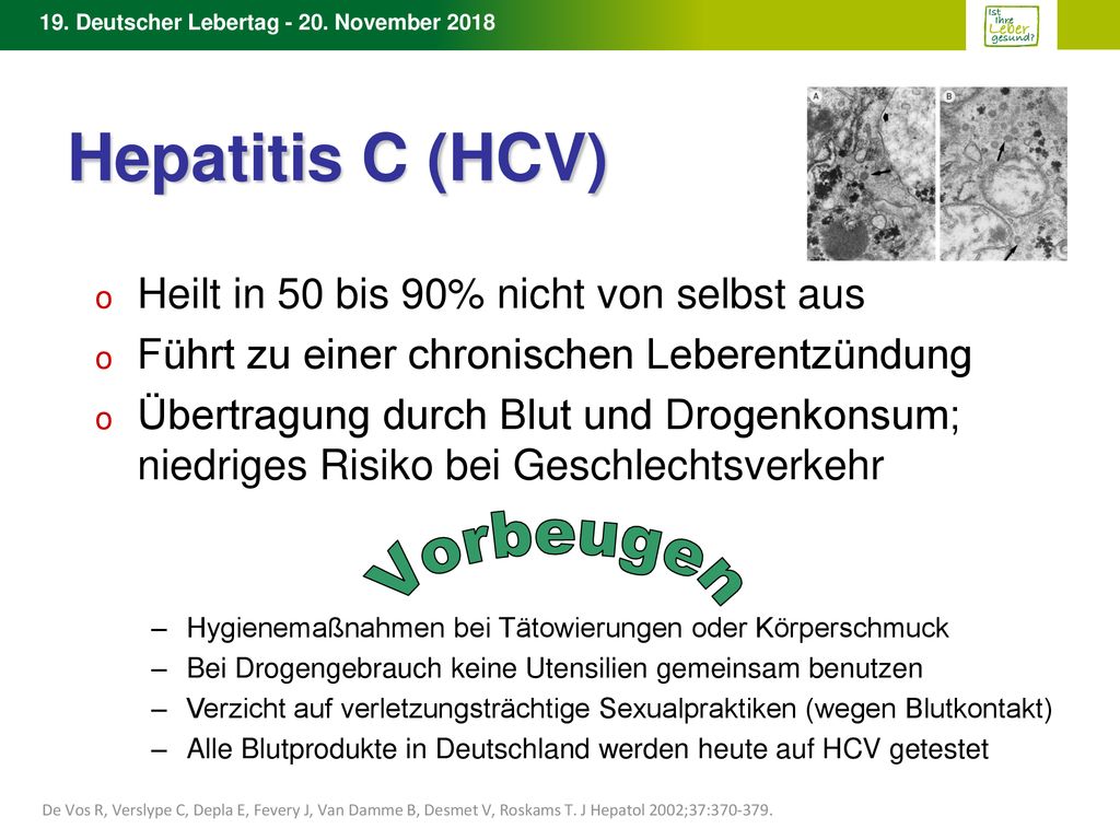 Hepatitis C (HCV) Vorbeugen Heilt in 50 bis 90% nicht von selbst aus