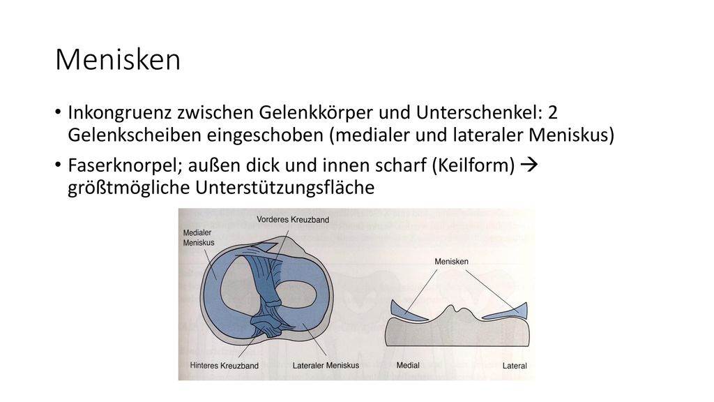Menisken Inkongruenz zwischen Gelenkkörper und Unterschenkel: 2 Gelenkscheiben eingeschoben (medialer und lateraler Meniskus)