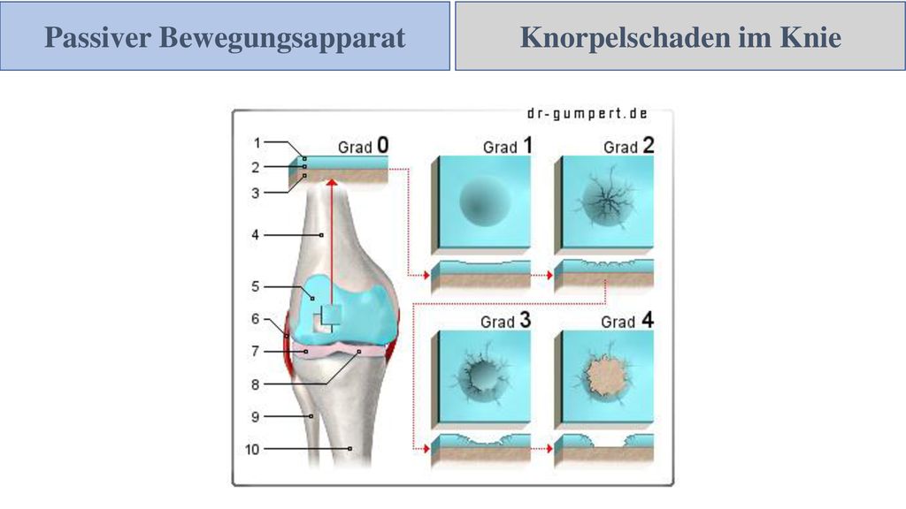 Passiver Bewegungsapparat Knorpelschaden im Knie
