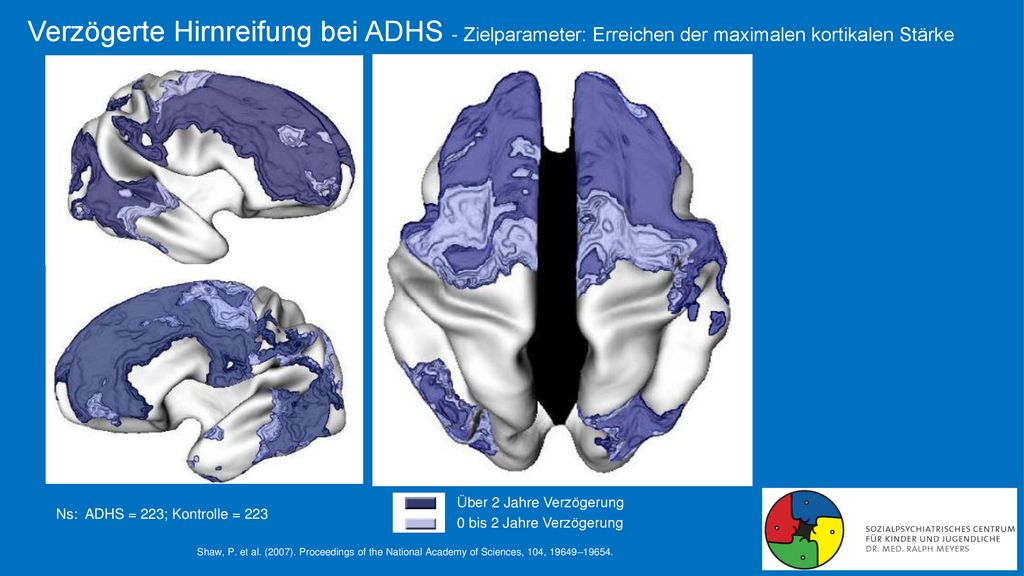 Verzögerte Hirnreifung bei ADHS - Zielparameter: Erreichen der maximalen kortikalen Stärke