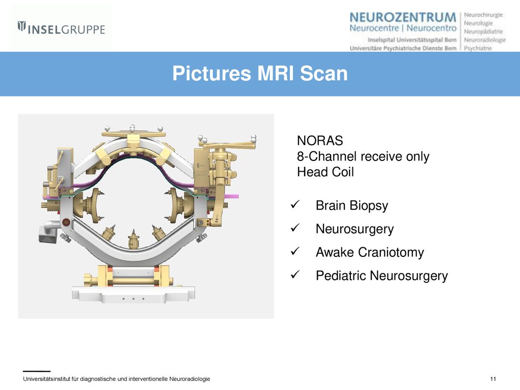 Pictures MRI Scan NORAS 8-Channel receive only Head Coil Brain Biopsy