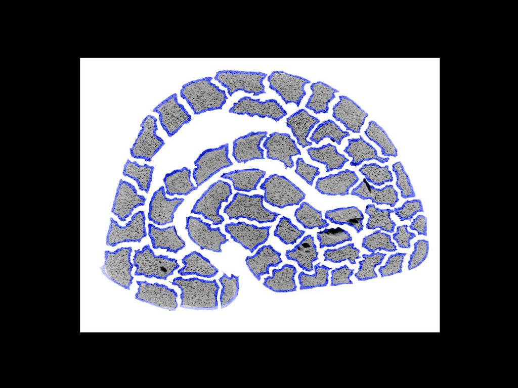 Grinding the coffee bean increases the number of cells water can access