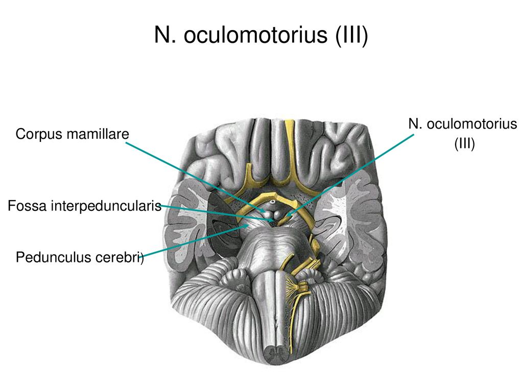 N. oculomotorius (III) N. oculomotorius Corpus mamillare (III)
