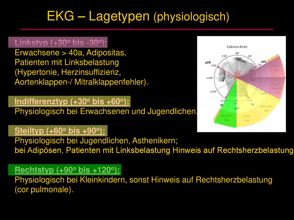 EKG – Lagetypen (physiologisch)