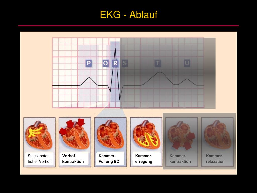EKG - Ablauf Sinusknoten hoher Vorhof Vorhof- kontraktion Kammer-