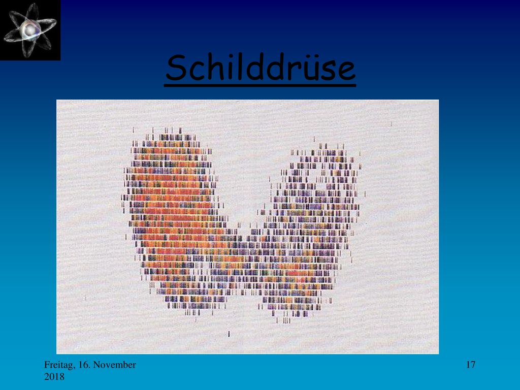 Schilddrüse Freitag, 16. November 2018Freitag, 16. November 2018