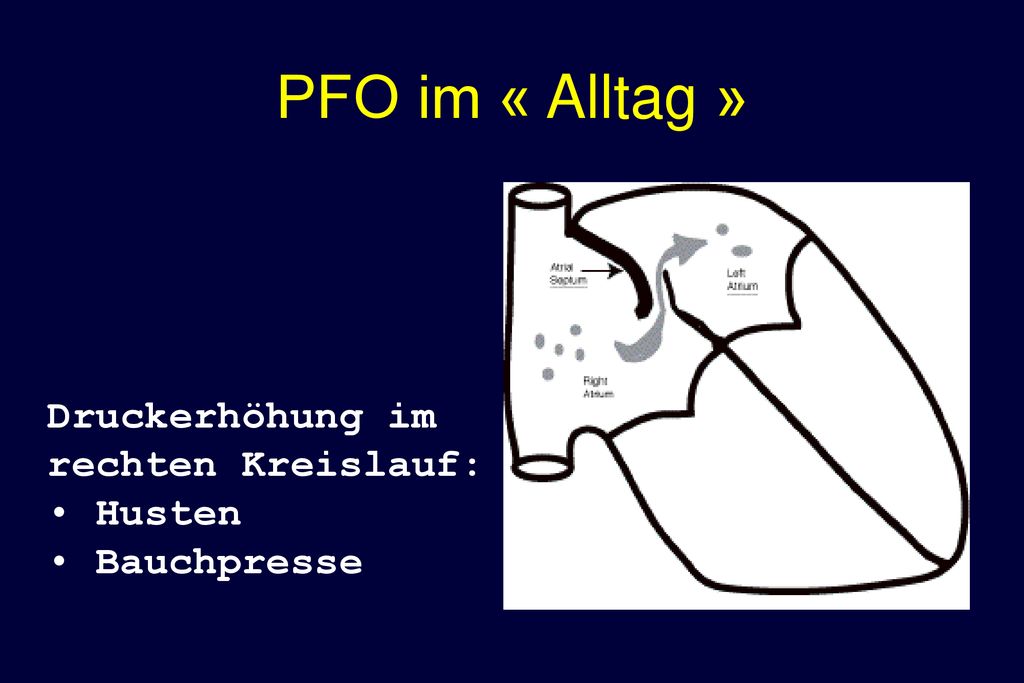 PFO im « Alltag » Druckerhöhung im rechten Kreislauf: Husten