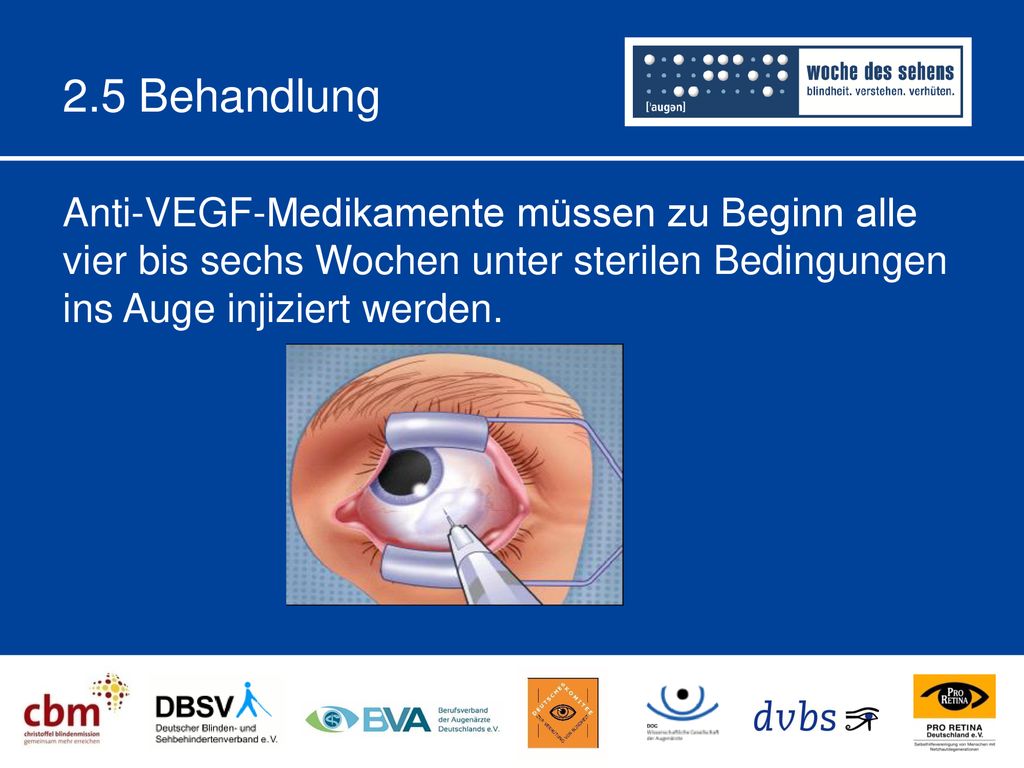 2.5 Behandlung Anti-VEGF-Medikamente müssen zu Beginn alle vier bis sechs Wochen unter sterilen Bedingungen ins Auge injiziert werden.