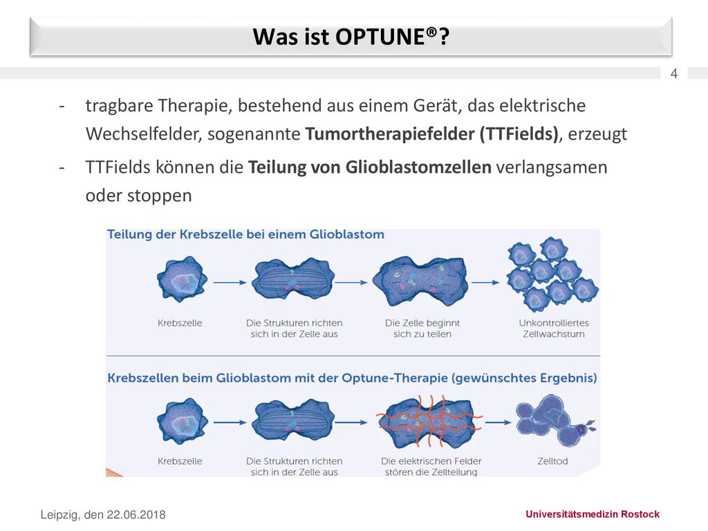 Was ist OPTUNE® 4. tragbare Therapie, bestehend aus einem Gerät, das elektrische Wechselfelder, sogenannte Tumortherapiefelder (TTFields), erzeugt.