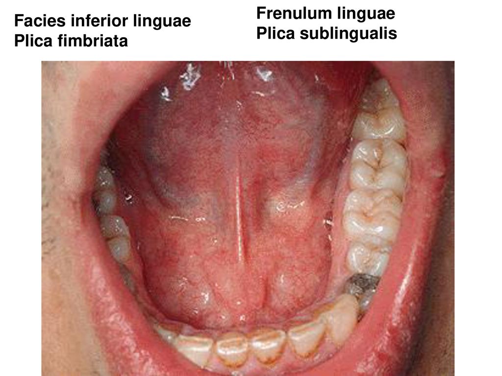 Frenulum linguae Plica sublingualis Facies inferior linguae Plica fimbriata