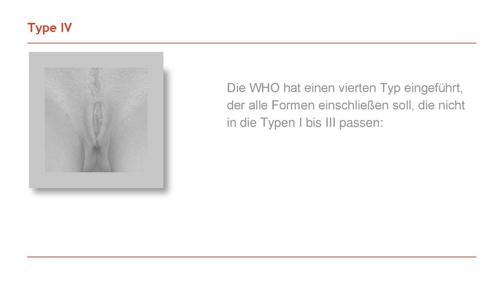 Type IV Die WHO hat einen vierten Typ eingeführt, der alle Formen einschließen soll, die nicht in die Typen I bis III passen: