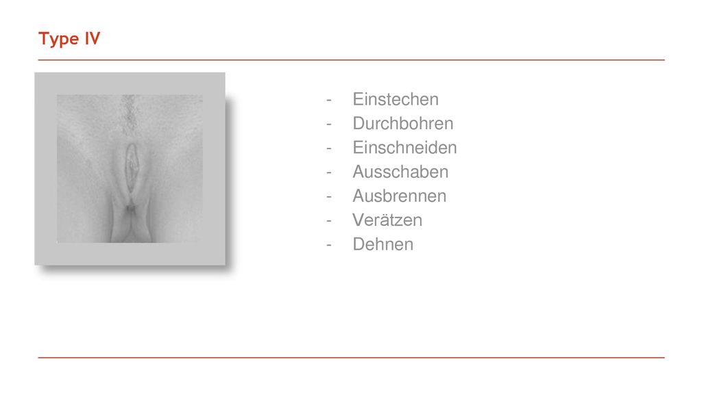 Type IV Einstechen Durchbohren Einschneiden Ausschaben Ausbrennen Verätzen Dehnen