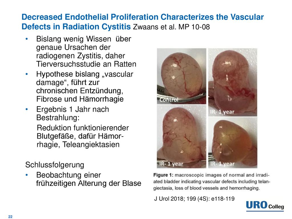 Decreased Endothelial Proliferation Characterizes the Vascular Defects in Radiation Cystitis Zwaans et al. MP 10-08