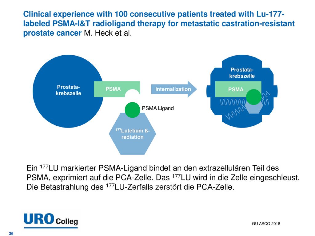 Clinical experience with 100 consecutive patients treated with Lu-177-labeled PSMA-I&T radioligand therapy for metastatic castration-resistant prostate cancer M. Heck et al.