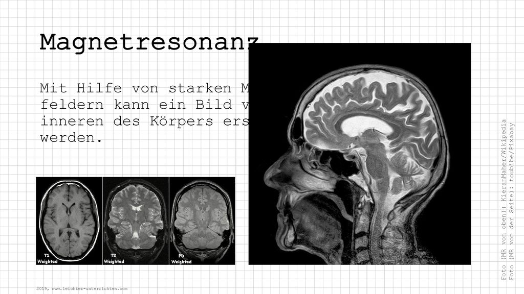 Magnetresonanz Mit Hilfe von starken Magnet- feldern kann ein Bild vom inneren des Körpers erstellt werden.