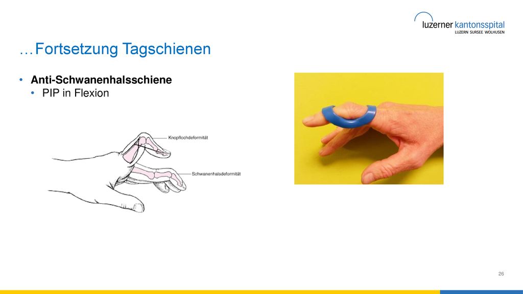 …Fortsetzung Tagschienen