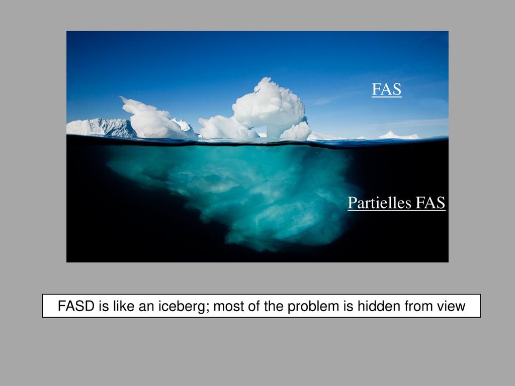 FASD is like an iceberg; most of the problem is hidden from view