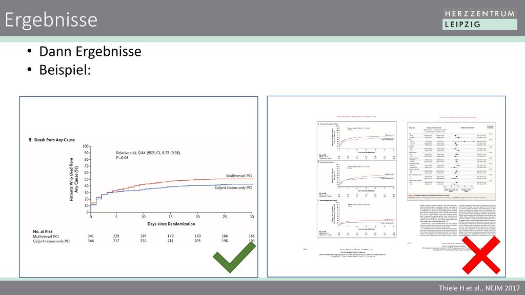 Ergebnisse Dann Ergebnisse Beispiel: Thiele H et al., NEJM 2017
