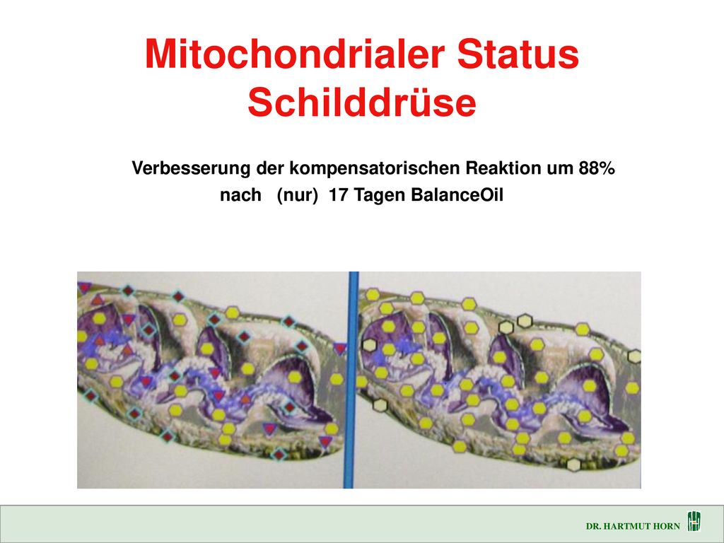 Mitochondrialer Status Schilddrüse Verbesserung der kompensatorischen Reaktion um 88% nach (nur) 17 Tagen BalanceOil