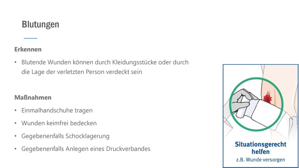Blutungen Erkennen. Blutende Wunden können durch Kleidungsstücke oder durch die Lage der verletzten Person verdeckt sein.