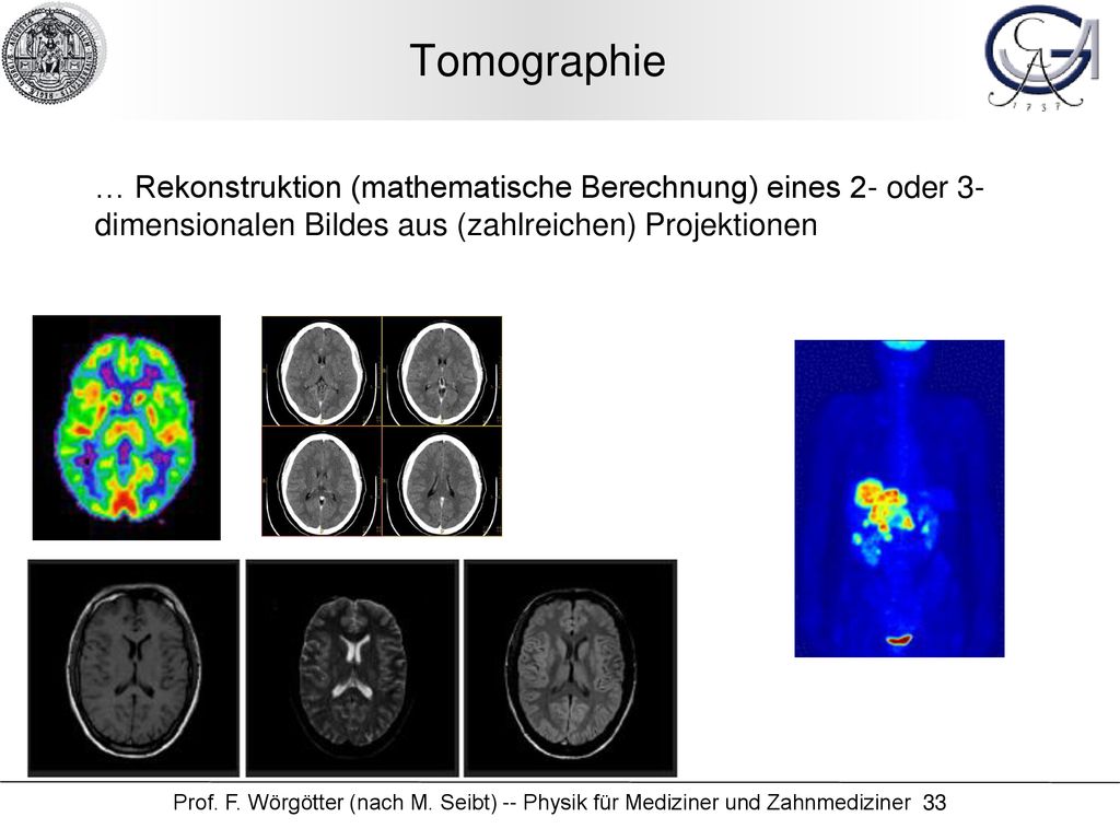 Tomographie … Rekonstruktion (mathematische Berechnung) eines 2- oder 3-dimensionalen Bildes aus (zahlreichen) Projektionen.