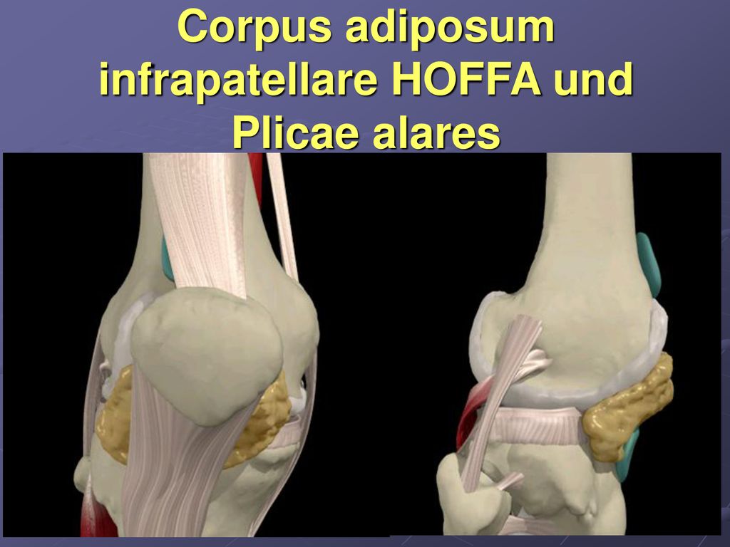 Corpus adiposum infrapatellare HOFFA und Plicae alares