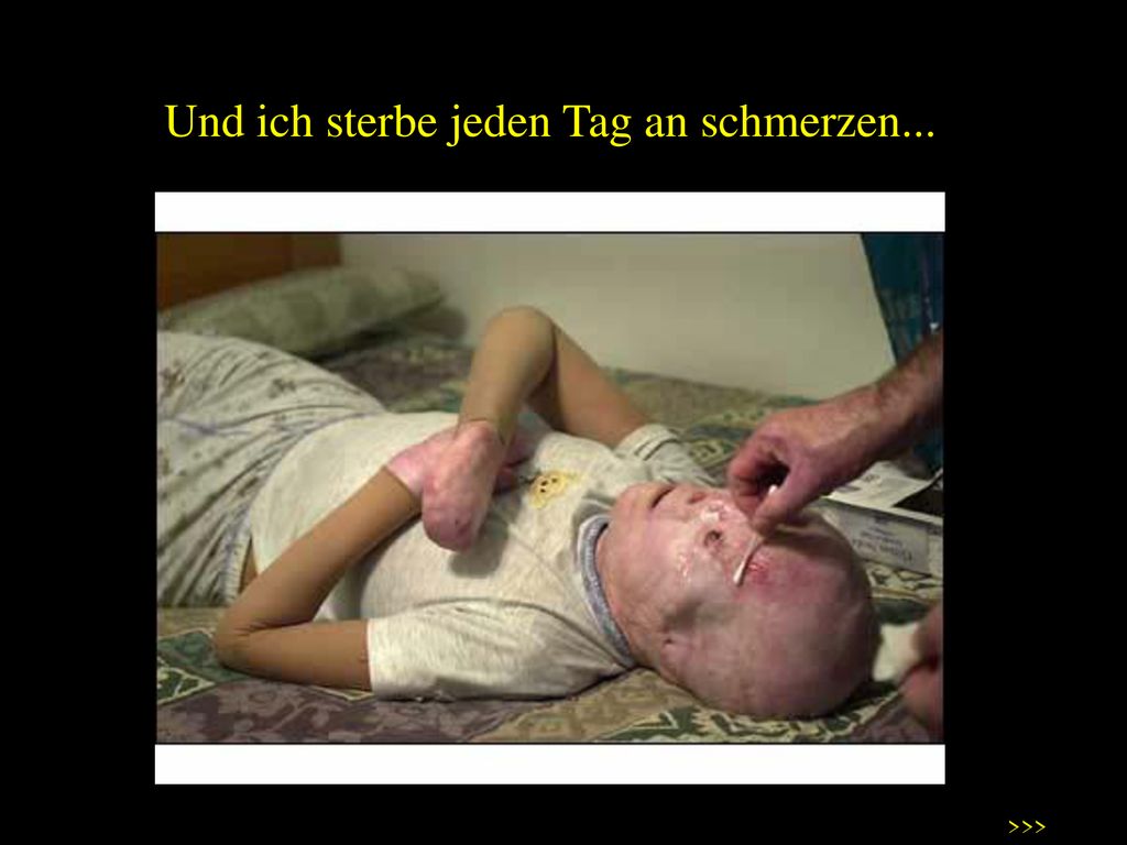 Und ich sterbe jeden Tag an schmerzen...