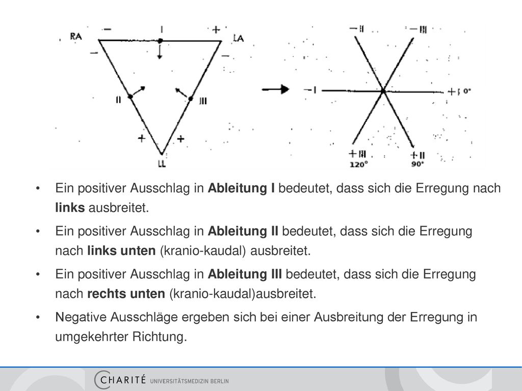 Ein positiver Ausschlag in Ableitung I bedeutet, dass sich die Erregung nach links ausbreitet.
