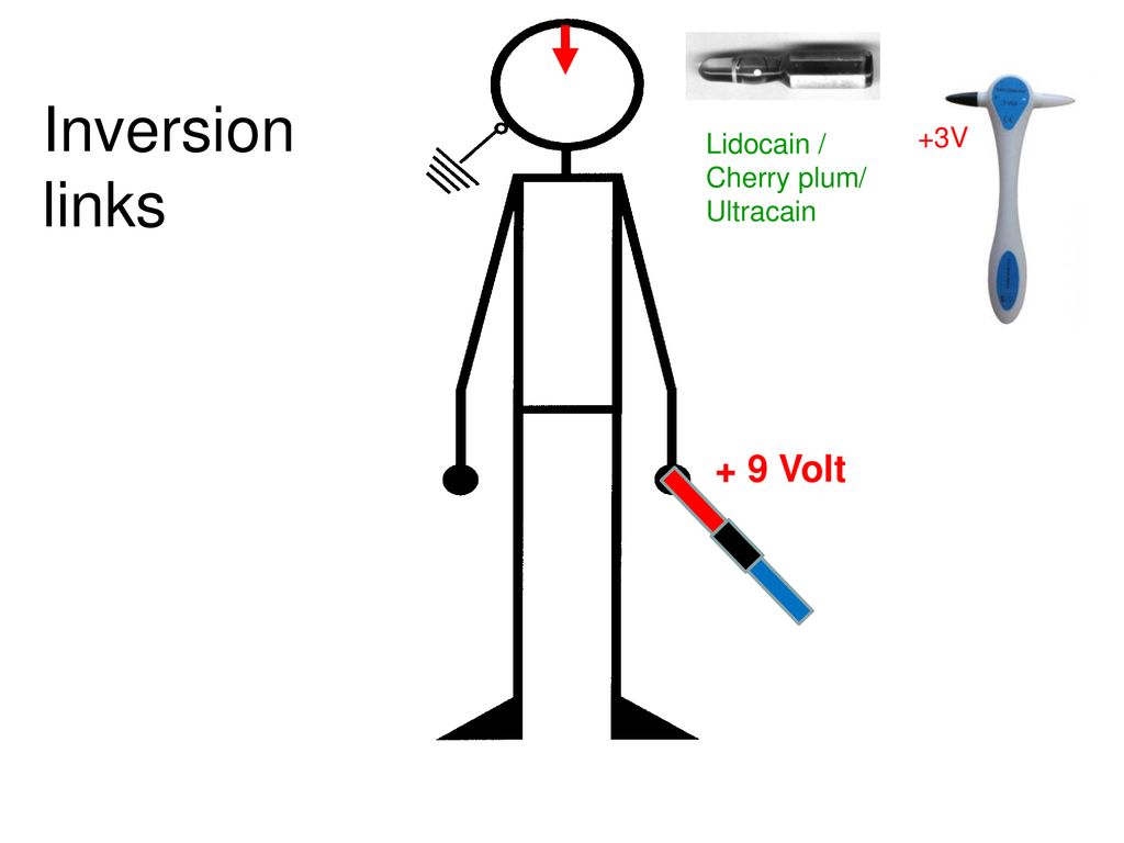 +3V Inversion links Lidocain / Cherry plum/ Ultracain + 9 Volt