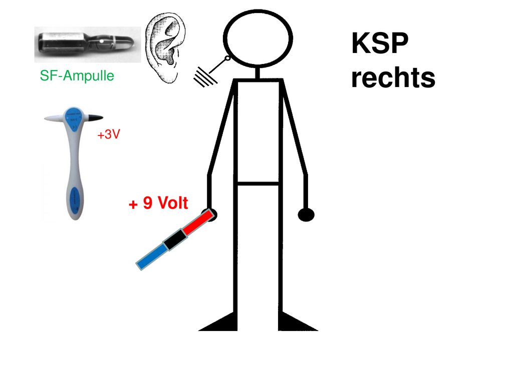 KSP rechts + 9 Volt Unabhängig der Lateralität SF-Ampulle +3V