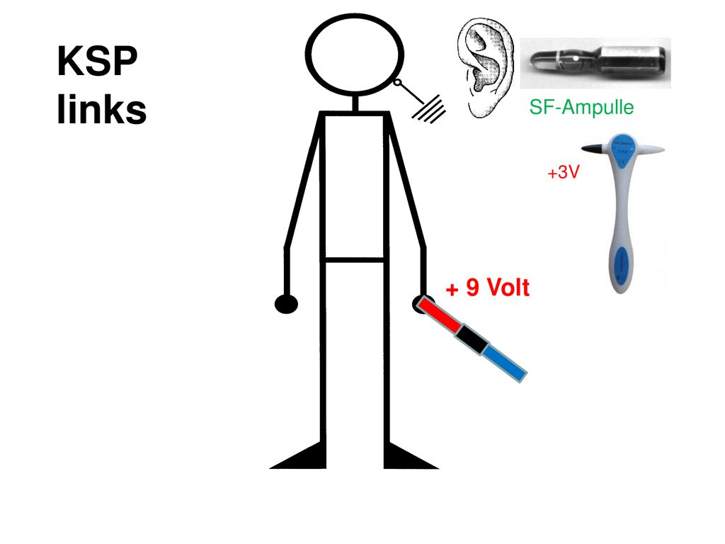 KSP links + 9 Volt Unabhängig der Lateralität SF-Ampulle +3V
