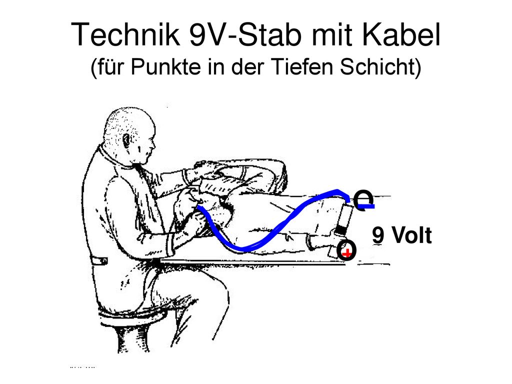 Technik 9V-Stab mit Kabel (für Punkte in der Tiefen Schicht)