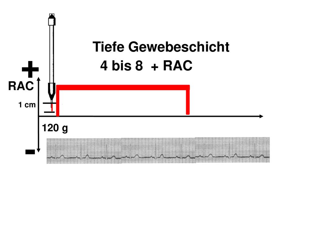 + - Tiefe Gewebeschicht 4 bis 8 + RAC RAC 120 g