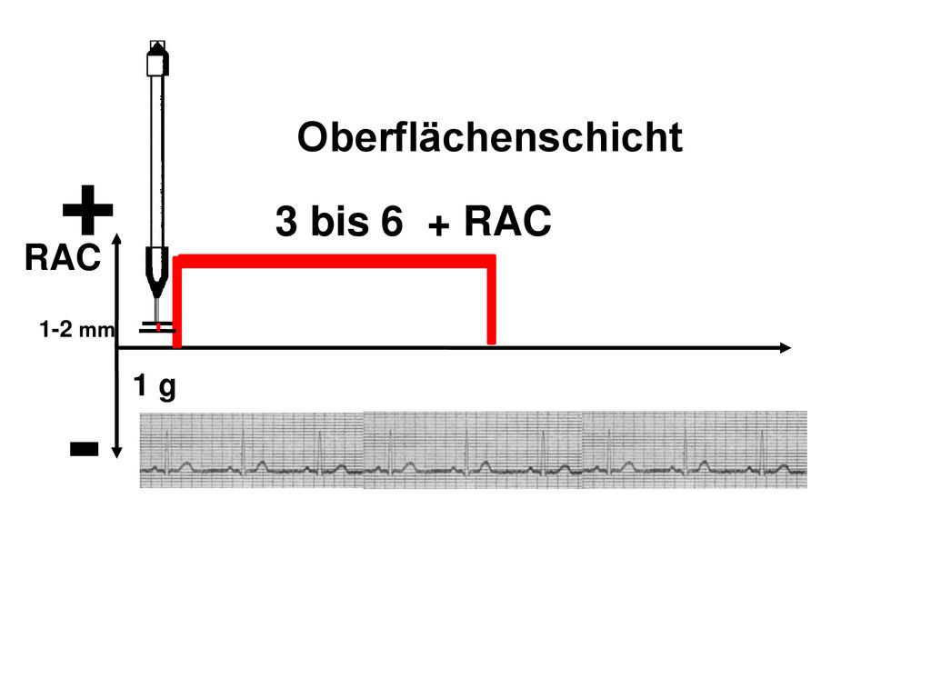 + - Oberflächenschicht 3 bis 6 + RAC RAC 1 g