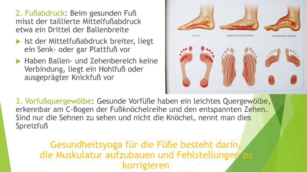 2. Fußabdruck: Beim gesunden Fuß misst der taillierte Mittelfußabdruck etwa ein Drittel der Ballenbreite