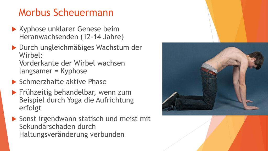 Morbus Scheuermann Kyphose unklarer Genese beim Heranwachsenden (12-14 Jahre)
