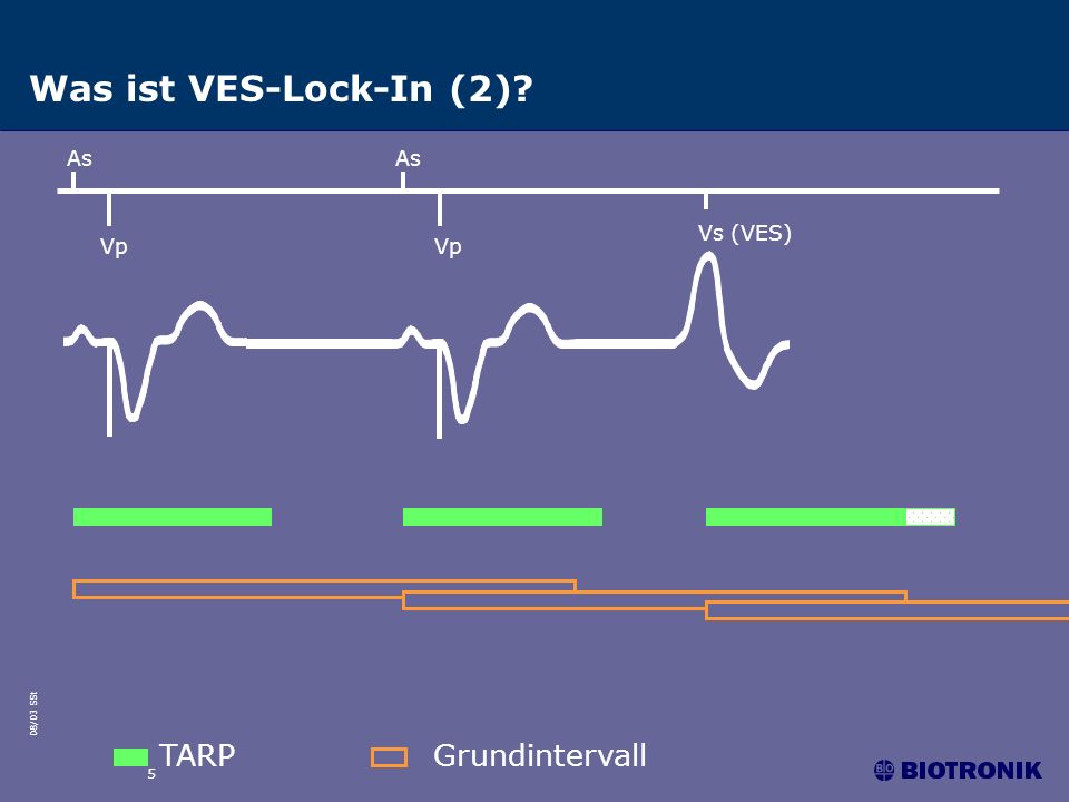 Was ist VES-Lock-In (2) As As Vs (VES) Vp Vp TARP Grundintervall 5