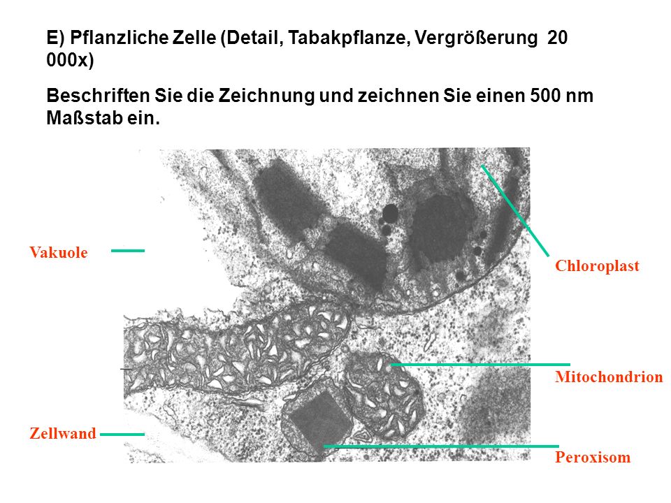 E) Pflanzliche Zelle (Detail, Tabakpflanze, Vergrößerung x)